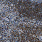 Immunohistochemical staining of human tonsil shows strong cytoplasmic-membranous positivity in non-germinal center cells.
