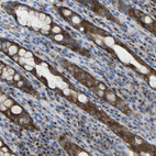 Immunohistochemical staining of human rectum strong cytoplasmic positivity in glandular cells.