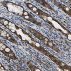 Immunohistochemical staining of human rectum strong cytoplasmic positivity in glandular cells.
