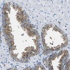 Immunohistochemical staining of human prostate shows moderate cytoplasmic positivity in glandular cells.