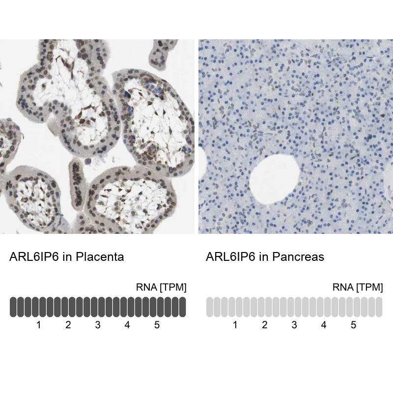 Anti-ARL6IP6 Antibody