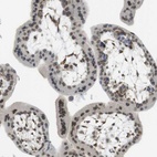 Immunohistochemical staining of human placenta shows high expression.