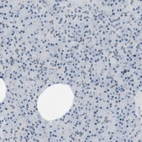 Immunohistochemical staining of human pancreas shows low expression as expected.