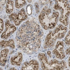 Immunohistochemical staining of human kidney shows strong granular cytoplasmic positivity in cells in tubules.