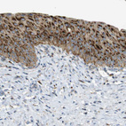 Immunohistochemical staining of human urinary bladder shows strong granular cytoplasmic positivity in urothelial cells.