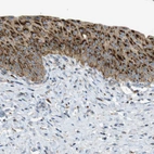 Immunohistochemical staining of human urinary bladder shows strong granular cytoplasmic positivity in urothelial cells.