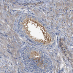 Immunohistochemical staining of human prostate shows moderate cytoplasmic positivity in glandular cells.