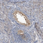 Immunohistochemical staining of human prostate shows moderate cytoplasmic positivity in glandular cells.