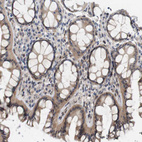 Immunohistochemical staining of human colon shows weak cytoplasmic positivity in glandular cells.