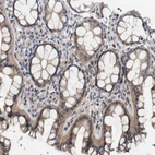Immunohistochemical staining of human colon shows weak cytoplasmic positivity in glandular cells.
