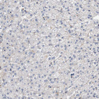 Immunohistochemical staining of human liver shows no positivity in hepatocytes as expected.