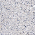 Immunohistochemical staining of human liver shows no positivity in hepatocytes as expected.