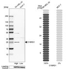 Western blot analysis in human cell lines SK-MEL-30 and MCF-7 using Anti-CYBRD1 antibody. Corresponding CYBRD1 RNA-seq data are presented for the same cell lines. Loading control: Anti-PFN1.
