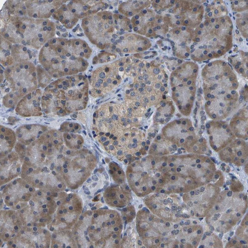 Anti-DSE Antibody