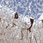 Immunohistochemical staining of human cerebellum shows moderate to strong cytoplasmic positivity in Purkinje cells.
