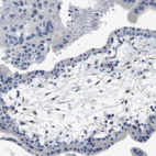 Immunohistochemical staining of human placenta shows no positivity in trophoblastic cells as expected.