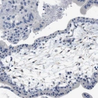 Immunohistochemical staining of human placenta shows no positivity in trophoblastic cells as expected.