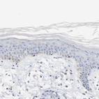 Immunohistochemical staining of human skin shows no positivity in epidermal cells as expected.