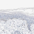 Immunohistochemical staining of human skin shows no positivity in epidermal cells as expected.