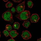 Anti-ST6GALNAC1 Antibody