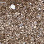 Anti-ALDH3A2 Antibody