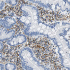 Anti-MS4A10 Antibody