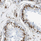 Immunohistochemical staining of human testis shows strong cytoplasmic-membranous positivity in cells in seminiferous ducts and Leydig cells.