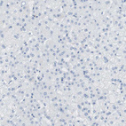Anti-MS4A10 Antibody