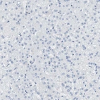 Immunohistochemical staining of human liver shows negative positivity in hepatocytes as expected.