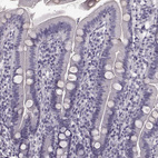 Anti-TRPM1 Antibody