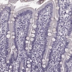 Immunohistochemical staining of human duodenum shows no positivity in glandular cells.