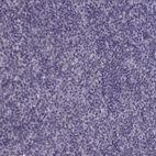 Anti-TRPM1 Antibody