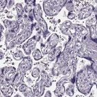 Immunohistochemical staining of human placenta shows no positivity in trophoblastic cells.