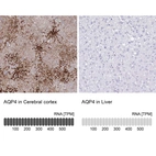 Anti-AQP4 Antibody