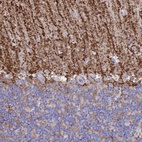 Anti-AQP4 Antibody