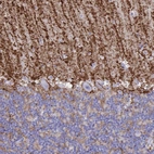 Immunohistochemical staining of human cerebellum shows moderate to strong membranous positivity in astrocytes, mainly in the molecular layer.
