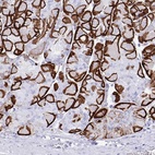 Anti-AQP4 Antibody