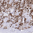 Immunohistochemical staining of human stomach shows strong membranous positivity in glandular cells.