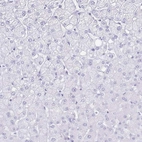 Immunohistochemical staining of human liver shows no positivity in hepatocytes, as expected.