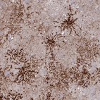 Immunohistochemical staining of human cerebral cortex shows moderate to strong membranous positivity in astrocytes.