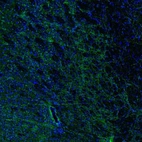 Immunofluorescence staining of mouse basal forebrain shows positivity in a subset of astrocytes in the caudate putamen.