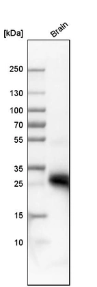 Western blot analysis in human brain tissue.