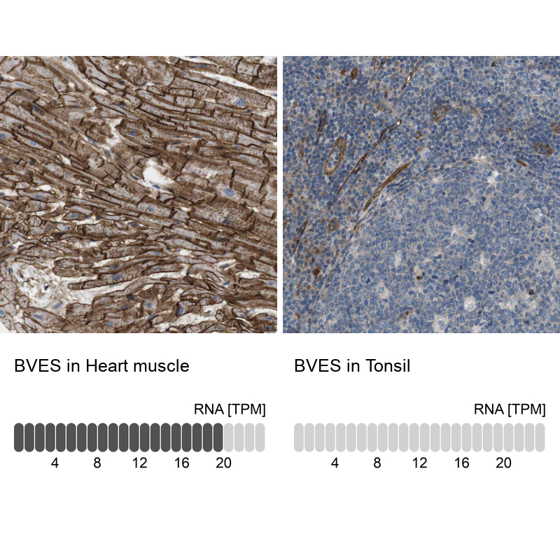 Anti-BVES Antibody