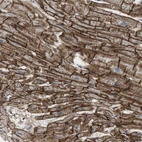 Immunohistochemical staining of human heart muscle shows high expression.