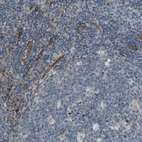 Immunohistochemical staining of human tonsil shows low expression as expected.