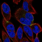 Immunofluorescent staining of human cell line RH-30 shows localization to cell junctions.