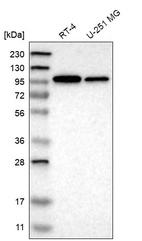 Western blot analysis in human cell line RT-4 and human cell line U-251 MG.