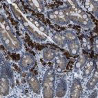 Anti-CLPTM1L Antibody