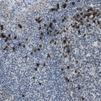 Immunohistochemical staining of human tonsil shows strong cytoplasmic positivity in non-germinal center cells.