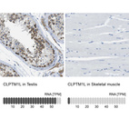 Anti-CLPTM1L Antibody